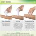 Memine EZ Bites Relief Suction Tool - Venom Extractor for Bee Stings - Kids Friendly - Reduce Itch & Swelling - White/1 Pack - Buy Online on GoSupps.com