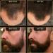 Hairline Powder by The Beard Struggle - Root Touch Up Hair Color for Men | Conceals Hair Loss & Bald Spots | Sweat Resistant Dark Brown - Buy Online on GoSupps.com