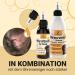 Canifee Ear Drops for Dogs - Manuka Oil & Yeast Mushroom Formula 110ml - Natural Ear Mite & Inflammation Care - Buy Online on GoSupps.com