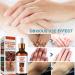 Dark Knuckle Whitening Serum Dark Knuckle Whitening Cream for Dark Knuckle Corrector Lighten Body Black Skin(50g) - Buy Online on GoSupps.com