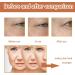 Hyaluronic Acid Serum for Face - Face Serum for Women - Cheery Dark Spot Remover for Face Serum - Anti-Aging Skin Firming - Moisturizing and Whitening - Mild Formula 30ml - Buy Online on GoSupps.com