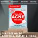 Acne Pimple Patches 120 Pack - Invisible Hydrocolloid Bandages with Tea Tree Oil for Spot Treatment - Blemish & Zit Stickers 120 Count - Buy Online on GoSupps.com