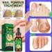 Nail oil for and strength natural plants nail care oil 30 ml strengthening care gel natural repair for home family friendly stressed nails - Buy Online on GoSupps.com