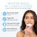 Bloom Teeth Whitening Kit | Fast Acting 35% Carbamide Peroxide Gel + 5X LED Light | Whiten Teeth in 10 Minutes | No Sensitivity with Coconut Oil & Hydroxyapatite - Buy Online on GoSupps.com