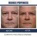 Weybohu 3Pcs Himse Awaken Peptide Depuffing Eye Gel - Men's Anti-Wrinkle & Moisturizing Eye Cream for Dark Circles & Under Eye Bags - Buy Online on GoSupps.com