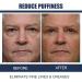 OPENEYES Peptide Eye Gel & Depuffing Cream for Men - Dark Circles & Puffiness (30g) - Buy Online on GoSupps.com
