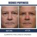 OpenEyes Rejuvenating Eye Lifting Gel for Men & Women - Peptide Eye Gel for Tightening & Awakening - 45g - Buy Online on GoSupps.com