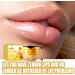 Auflosung Honey Lip Balm Moisturizing Honey Lip Mask with Propolis Extract Prevents Dry and Cracked Lips Reduces Lip Wrinkles Nighttime Lip Treatment - Buy Online on GoSupps.com