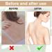 Homury 5-Piece Wooden Back Scratcher Set | Bamboo Body Massager for Itching Relief & Relaxation - Buy Online on GoSupps.com