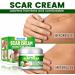 Natural Aloe Vera Scar Cream 20g Helps Soothe Acne Scars C-Section Scars Burns And Surgery Scars Works On Both Old And New Scars - Buy Online on GoSupps.com