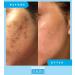 Admire My Skin Dark Spot Corrector Serum + Retinoid Cream Set - Buy Online on GoSupps.com