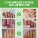 15ml Keratin 3 Days Growth Nail Treatment&Strengthener Nail Growth Treatment for Nail Repair Nail Strengthener for Damaged Nails Extra Strong Growth Nail Polish Nail Oil Treatment for Damaged Nails - Buy Online on GoSupps.com