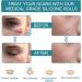 Silicone Scar Roll for Scars & Keloids | Reusable 4cm x 1.5m | Ideal for Caesarean & Face Scarring - Buy Online on GoSupps.com