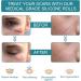Silicone Scar Sheets Professional Silicone Scar Sheets Scar Silicone Tape Strips Scar Removal Sheets for C-Section Surgery Burn Keloid Acne (1.5 Meters(4 Month Supply) - Buy Online on GoSupps.com