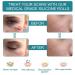 Silicone Scar Sheets - Effective Scar Treatment for Smoother Skin - Buy Online on GoSupps.com