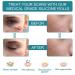 Medical Grade Silicone Scar Tape Roll (1.6 x 60) for Scar Removal - Professional Silicone Strips for Surgery, C-Section, Acne, Burn and Keloid - Safe & Reusable - 1.5M - Buy Online on GoSupps.com