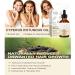 2 PCS Cyperus Rotundus Oil Cyperus Rotundus Oil for Hair Removal Reduces Unwanted Body Hair Growth Moisturize Smooth Skin for All Skin Types for Women & Man 2.02 Fl Oz (Pack of 2) 2 - Buy Online on GoSupps.com