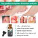 Ingrown Toenail Treatment Kit - Softener Drops Lifter Nail Patches & Tools for Easy Home Care - Buy Online on GoSupps.com