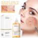 Mikabila 240ml Glycolic Acid 7% Toning Resurfacing Solution Glycolic Acid Toner Moisturize & Strengthen Skin Glycolic Sour 7% Toner Hydrating Toner Rejuvenate Moisturize & Strengthen Your Skin - Buy Online on GoSupps.com