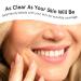Grace & Stella Pimple Patches for Face - 72 Hydrocolloid Acne Patches | Vegan & Cruelty-Free Blemish Stickers Dermatologist Tested - Buy Online on GoSupps.com