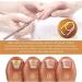 Cuticle Remover Cream Nail Cuticle Repair Gel Supremely Gentle Cuticle Remover Nail Treatments for Cuticle Softener Nail Cuticle Care Gel for Used to Repair Nail Damage & Moisturize Manicure 30ML - Buy Online on GoSupps.com