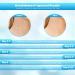 2-in-1 Skin Tag Remover Device for Small to Large Skin Tags | Easy Application in Minutes | Includes 40 Micro and Regular Bands - Buy Online on GoSupps.com