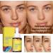 Correcting Face Serum Spot Remover For Face Color Correcting Serum Brightening Serum Face Serums Moisturiser Face Whitening Serum Anti Aging Serum For Face Skincare - Buy Online on GoSupps.com