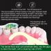 Travel-Friendly Toothpicks - 75pcs Gentle Daily Use for Perfect Teeth Care - Buy Online on GoSupps.com