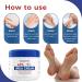 OUKEYA Cr me d'Ur e Nouvelle Formule 40% Ur e Cr me Pieds et Mains pour Talons Crevass s et Peau S che Hydratante R paratrice Soin Anti-Callosit s NEW FORMULA Urea Cream 40% Cr me d'Ur e 40 + 2 SA - Buy Online on GoSupps.com