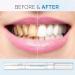 4 Pack Teeth Whitening Pens - Professional Abbey Whitening Essence for Painless Tooth Bleaching & Bright White Smile - Buy Online on GoSupps.com