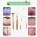 Stainless Steel Tongue Scraper Kit 3-Piece Oral Care Set for Fresh Breath | Tongue Cleaner with Metal Case - Buy Online on GoSupps.com