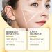 Hacaus Bee Venom Comprehensive Cream 2025 New Skincare Treatment Bee Venom Skin Cream Visibly reduces skin blemishes Natural Skin Moisturizer for Face and Body - Buy Online on GoSupps.com