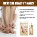 NailGrowth DeepHealing Organic Serum NailGrowth Nail Serum Reconstrux Nail Growth Nail Growth and Strengthening Serum Nail Serum for Growth and Repair for Damaged Nails (3PC) - Buy Online on GoSupps.com