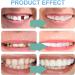 Frenzify Fake Braces Veneers - Instant Cosmetic Teeth Whitening & Denture Lightening for Bad Teeth - Buy Online on GoSupps.com