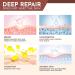 Silicone Scar Sheets Tape Roll 3M - Reusable Scar Removal Treatment for Keloid, Surgery, Burn, Acne - 1.6x120 - Effective Silicone Strips - Buy Online on GoSupps.com