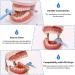 Complete IPR Kit for Orthodontic Treatment | Interproximal Enamel Reduction Set with Handpiece & Polishing Strips - Dental Tool for Tooth Gapping & Space Creation - Buy Online on GoSupps.com