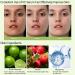 Green Tangerine Vitamin C Serum - Dark Spot Remover for Face - Face Serum for Women & Men - Brightening Moisturizing Facial Serum - Anti-wrinkle Anti-aging Antioxidant Serum 50ml - Buy Online on GoSupps.com