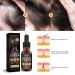 2PCS Allurium Hair Growth Serum for Black Women - Promotes Thicker, Stronger Hair - Anti Hair Loss and Thinning Hair Serum for Men & Women - Allurium Beauty - Buy Online on GoSupps.com