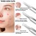 Pimple Popper Tool Kit - 15PCS Blackhead Remover & Extraction Tools for Estheticians - Buy Online on GoSupps.com