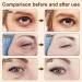 Barenkul Temporary Firming Eye Cream - 2023 Best Eye Firming Cream Set | Verticalox & Verfons Firming Eye Creams - Fades Fine Lines & Wrinkles (3 Pcs) - Buy Online on GoSupps.com