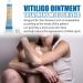 Vitiligo Repair Cream - Herbal Extract Treatment Ointment for Skin Pigmentation 0.7oz - Buy Online on GoSupps.com