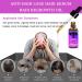 Trendyfave Hair Growth Serum Vitamins Serum for Hair Loss and Hair Regrowth Ginger Oil for Hair Growth for Balding Thinning Repairs Hair Follicles Natural Herbal Hair Growth Oils for Men and Women - Buy Online on GoSupps.com