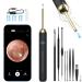 Ear Wax Removal - NIUQICT Ear Cleaner - Ear Camera 1080P with Lights - Ear Wax Removal Tool 9 Pcs - Ear Cleaning Kit  Wireless Otoscope Compatible with Android&iOS for Kids  Adults&Pets Golden Black