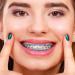Annhua Orthodontics Plastic Power Chain - Long Light Blue - Size 2# - 15ft Roll - Buy Online on GoSupps.com