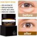 Snake Venom Eye Cream - Anti Wrinkle Eye Cream For Puffiness + Wrinkles Brightening Under Eye Cream Diminishing Deep Wrinkles Dark Circle Eye Cream Eye Bag Treatment For Men And Women 30g - Buy Online on GoSupps.com