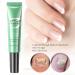 Nail & Cuticle Oil Pen Cuticle Oil Pen for Nail Care Hydrating Moisturising Cuticle Oil Nail Nutrition Pen Nail Growth Treatment Repair Treatment for Damaged Nails Nourish Dry Nails and Cuticles - Buy Online on GoSupps.com