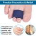 Sumifun Elasticity Toe Splint 4 Packs of Toe Wraps for Broken Toe Curled Toe Hammer Toe Toe Bandage for Big Toe Alignment Fracture Splint for Men or Women - Buy Online on GoSupps.com