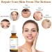 Retinol Serum for Face Retinol 1% in Squalane Reduce the Appearances of fine Lines of Photo Damage and of General Skin Ageing Acne Reduced Brighten & Smooth Skincare for Women & Men - Buy Online on GoSupps.com