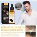 S rum Anti-Cheveux Gris Anti-Greying Hair Serums S rum Pour Cheveux Gris Huile Capillaire R paratrice Serum Cheveux Boucl s Natural Hair Darkening Serum Natural Ganoderma Hair Oil - Buy Online on GoSupps.com