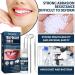 Temporary Tooth Repair Kit with Dental Mirror Tools - Replacement Beads for Missing & Broken Teeth - Buy Online on GoSupps.com